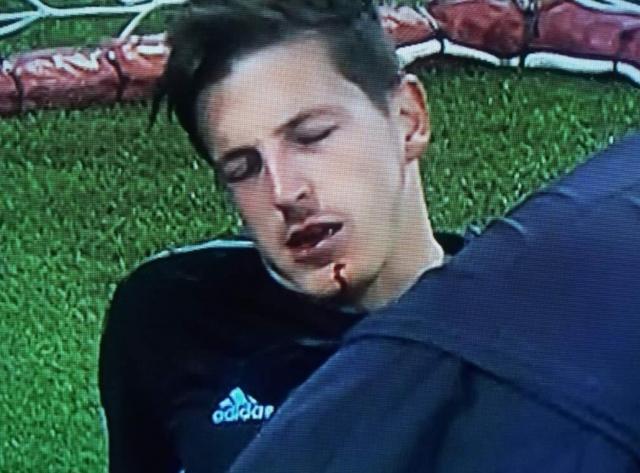 前意甲裁判：C罗踹破对方门将下巴，应该拿红牌