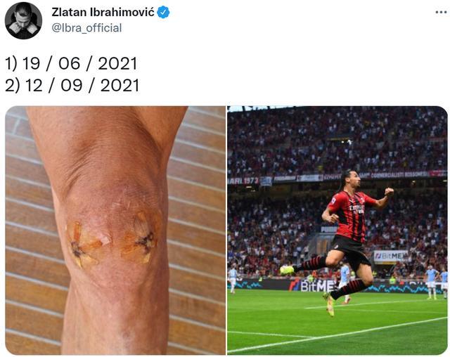 不到3个月就恢复，伊布晒6月伤口照与进球庆祝照