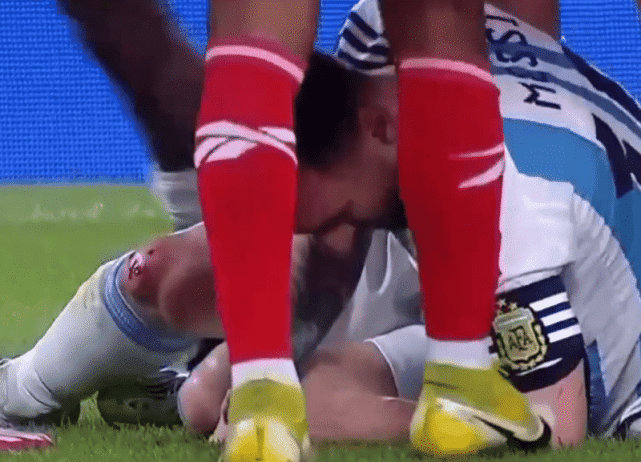 梅西遭对手双人飞铲膝盖被踢出血！阿根廷众将暴怒上前理论