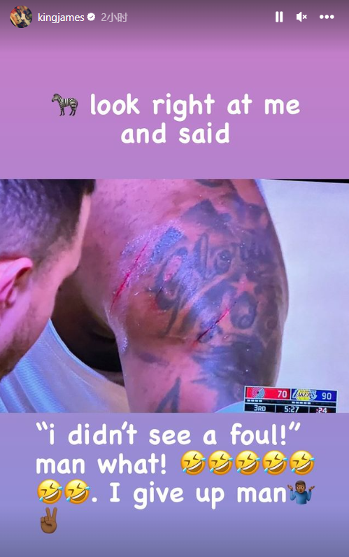 詹姆斯晒伤口抱怨裁判！爆粗回应喊暂停换下自己：别散播谣言了