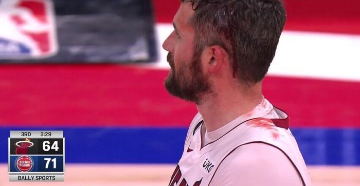 34岁乐福血染赛场：遭误伤头破血流缝了4针 血流不止染红战袍