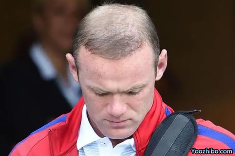 鲁尼头发现在怎么样了？鲁尼头发忽多忽少是怎么回事？