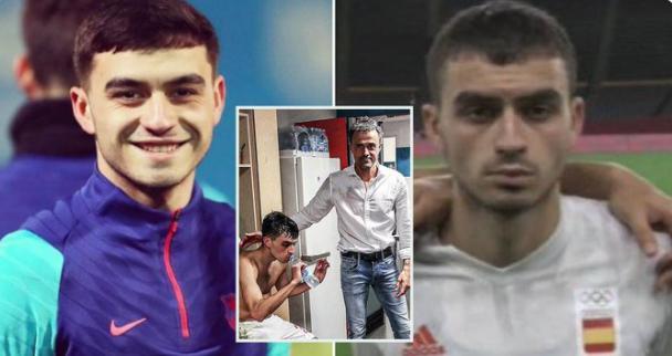 被榨干！球迷晒佩德里奥运照片：双眼无神疲惫不堪