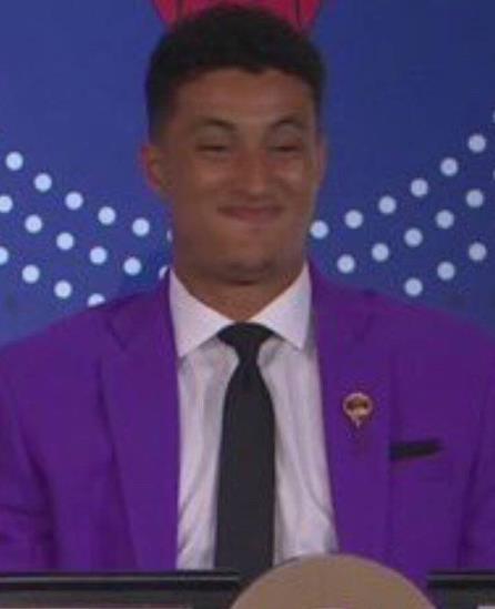 和珍妮阿姨传绯闻，放弃詹娜，库兹马为何选择了白癜风超模温妮？