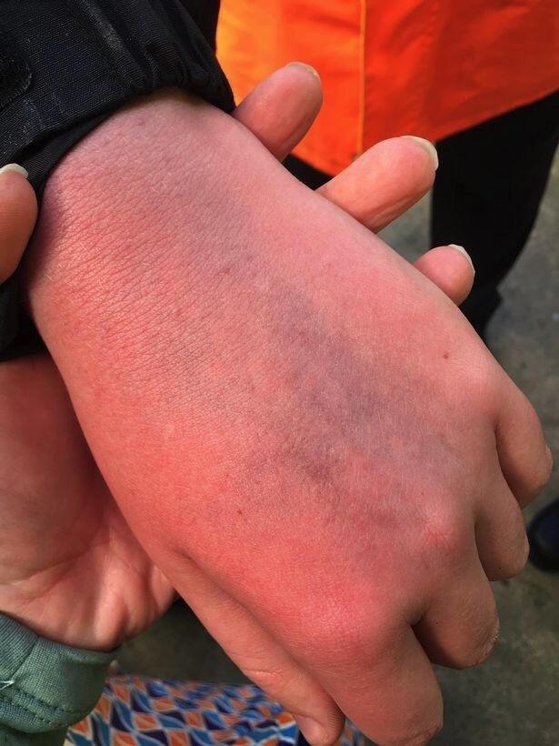 被C罗摔手机孩子仅14岁！患自闭症+运动障碍！