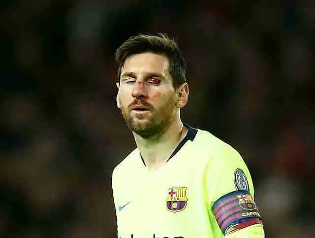 梅西受伤是怎么回事？梅西受伤最严重的是什么时候？