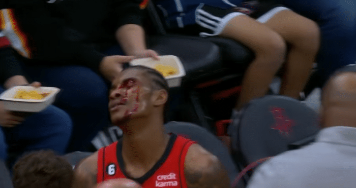 火箭新星血流满面：左眼被拉塞尔抓伤离场 对阵湖人半场8投轰18分