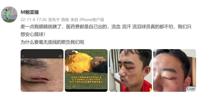 河北队门将：眼睛差点瞎了医药费自己出，欺负人！