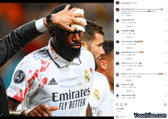 吕迪格95分钟头球助皇马绝平，头破血流缝20针